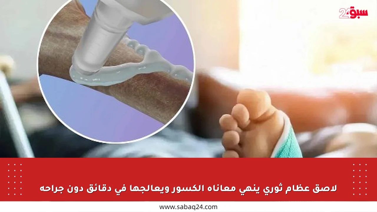 لاصق عظام ثوري ينهي معاناة الكسور ويعالجها في دقائق دون جراحة